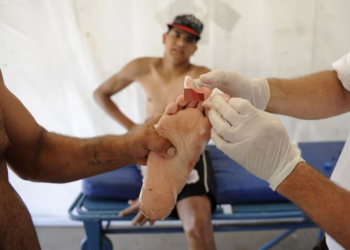 Ataque de palometas en la Laguna Setúbal: ¿Por qué ocurre este fenómeno y cómo prevenirlo?