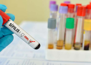 SIFILIS: Crecieron en un 42% los casos en cinco años.