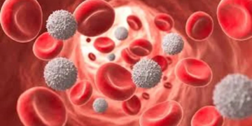 Enfermedad de Kawasaki: qué es y a quiénes afecta