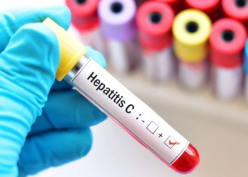 8 de cada 10 personas con hepatitis C aún no se trataron para curarse